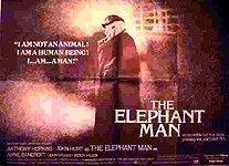 The Elephant Man 3704